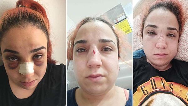 İzmir'de kafe çalışanı kadın, patronu tarafından fırça süpürgeyle darbedildi - Sputnik Türkiye