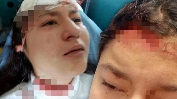 14 yaşındaki çocuğa selfie çekerken 5 köpek saldırdı - Sputnik Türkiye