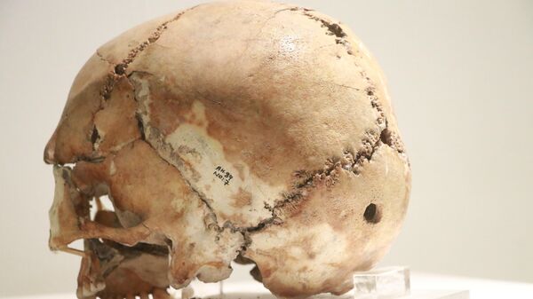 Dünyanın ilk beyin ameliyatı 10 bin 500 yıl önce Aksaray'da - Sputnik Türkiye
