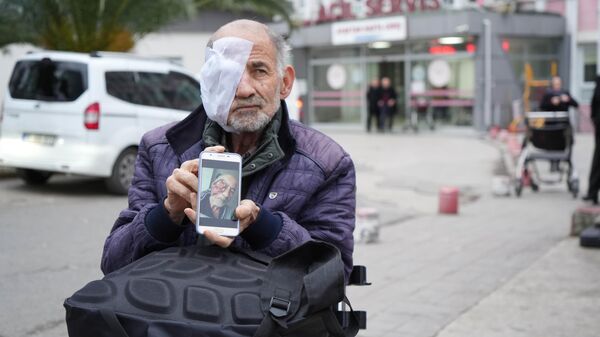 Sinop'ta yaşayan ve yüzünün yarısı cilt kanserinden eriyen yaşlı adam - Sputnik Türkiye