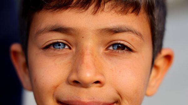Bir gözü mavi, diğer gözünün yarısı mavi yarısı kahverengi - Sputnik Türkiye