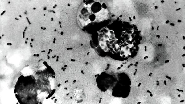 This Centers For Disease Control (CDC) file image obtained 15 January, 2003, shows the bubonic plague bacteria taken from a patient. - Sputnik Türkiye
