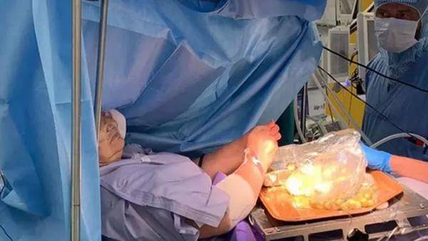 İtalya'da 60 yaşındaki kadın, beyin ameliyatı sırasında zeytin dolması yaptı - Sputnik Türkiye
